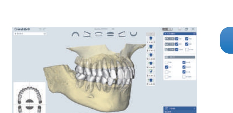 PlaniMax CT 3D 數位建模